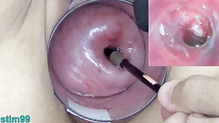 Grown-up Milf Cervix Play with Endoscope Japanese Cam into Uterus